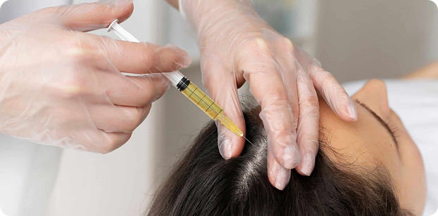 EXOSOMAS CAPILARES (TERAPIA REGENERATIVA AVANZADA)