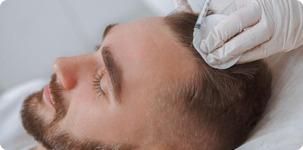 MESOTERAPIA  CAPILAR