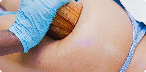 LEVANTAMIENTO DE GLÚTEOS