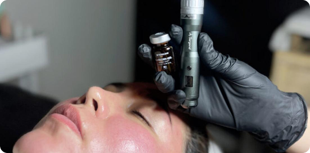 ESPERMOTERAPIA (ADN DE SALMÓN)