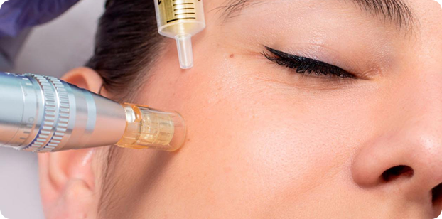 EXOSOMAS  FACIALES